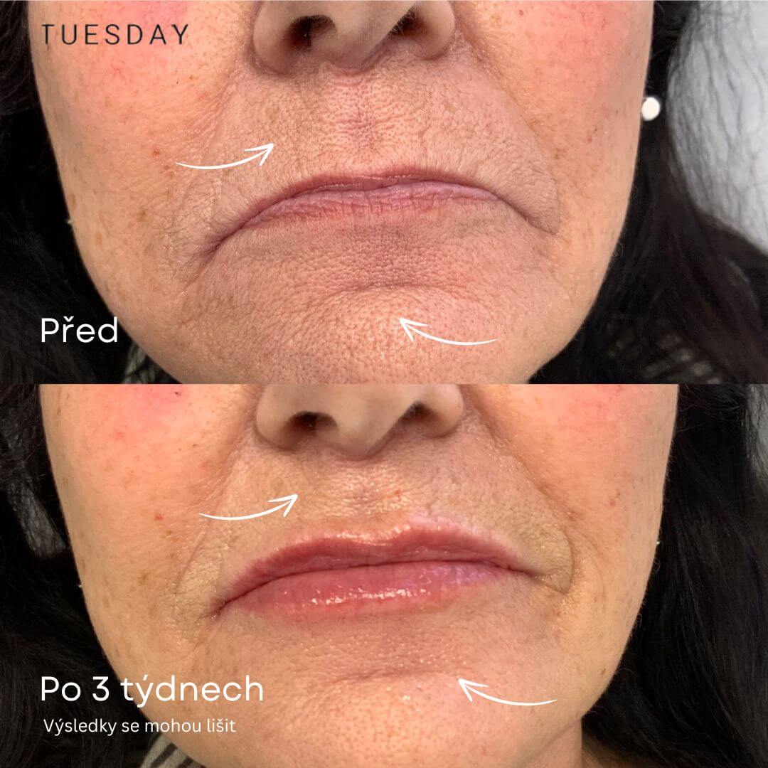 Sérum proti stárnutí z 24karátového zlata